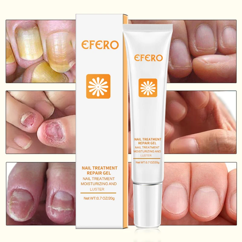 Eveline Cosmetics 8in1 Silver Shine Nail Therapy - Întăritor pentru unghii 8 în 1 | trucosblogger.es